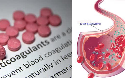 3 lý do cần thận trọng khi uống vitamin C cùng thuốc chống đông máu