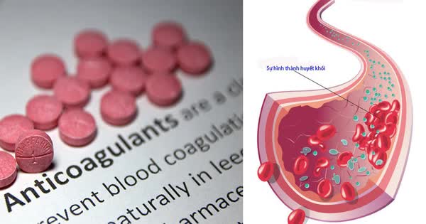 3 lý do cần thận trọng khi uống vitamin C cùng thuốc chống đông máu- Ảnh 1.