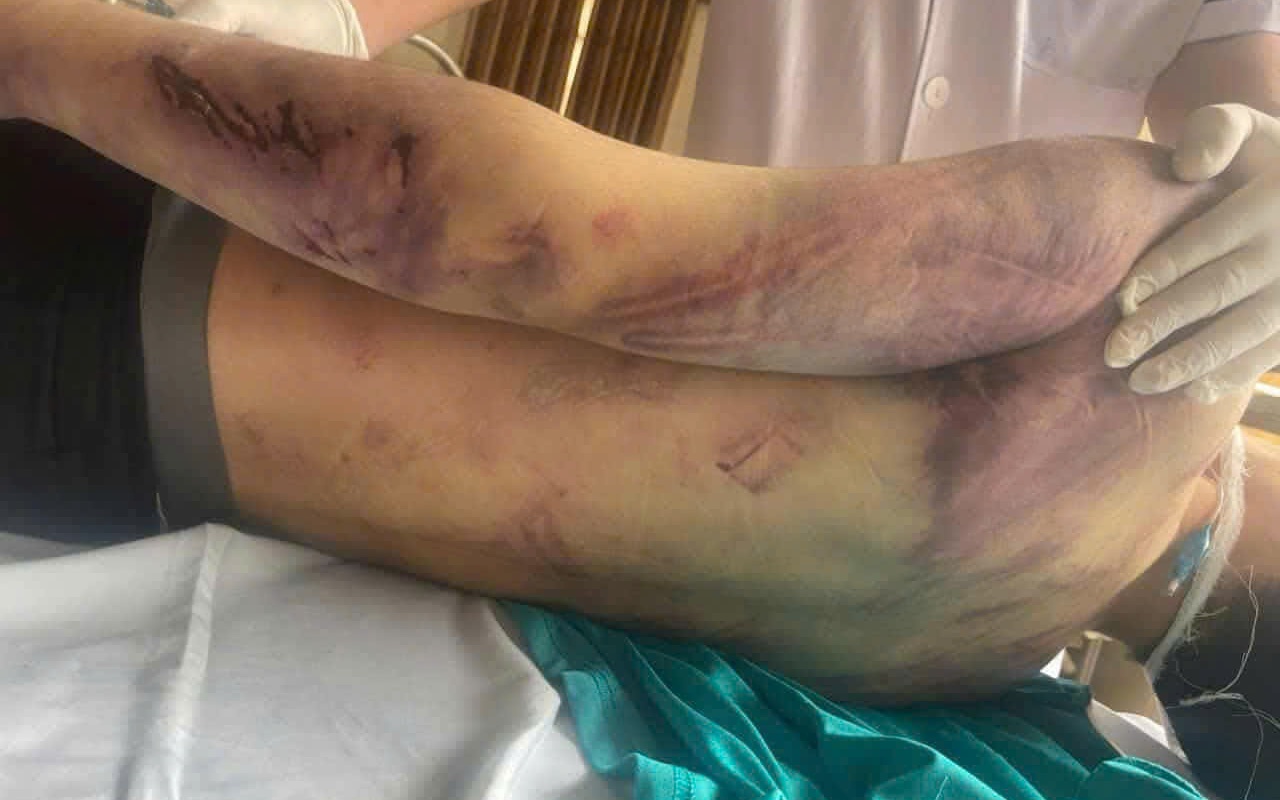 Tạm dừng trung tâm công tác xã hội có học viên tử vong sau 2 ngày nhập học- Ảnh 2.