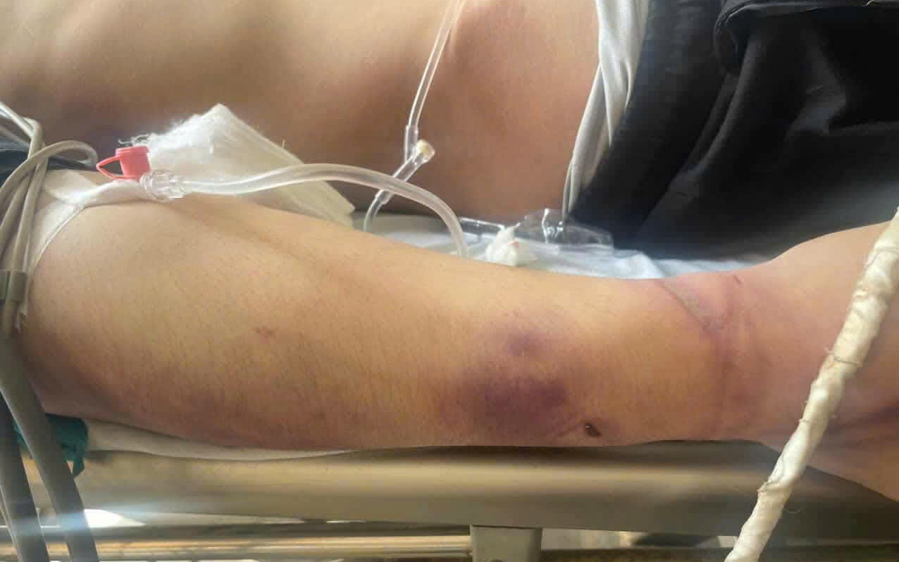 Tạm dừng trung tâm công tác xã hội có học viên tử vong sau 2 ngày nhập học