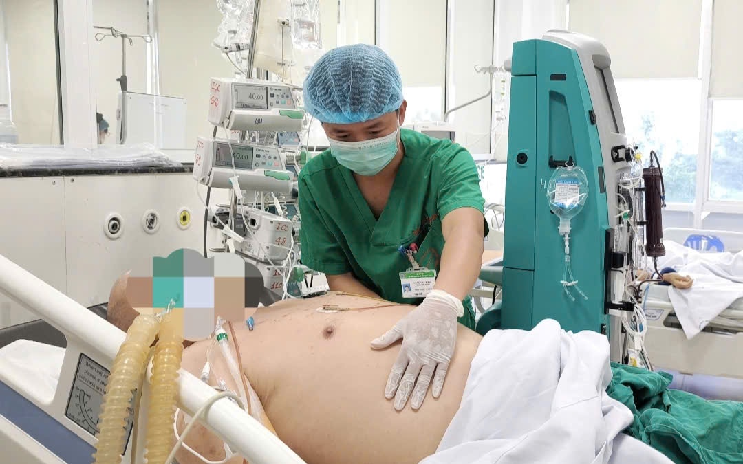 Nấm đen 'ăn' mòn xoang hàm người đàn ông khỏe mạnh- Ảnh 1.