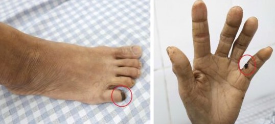 Nhập viện vì bị gà đạp - Ảnh 1.