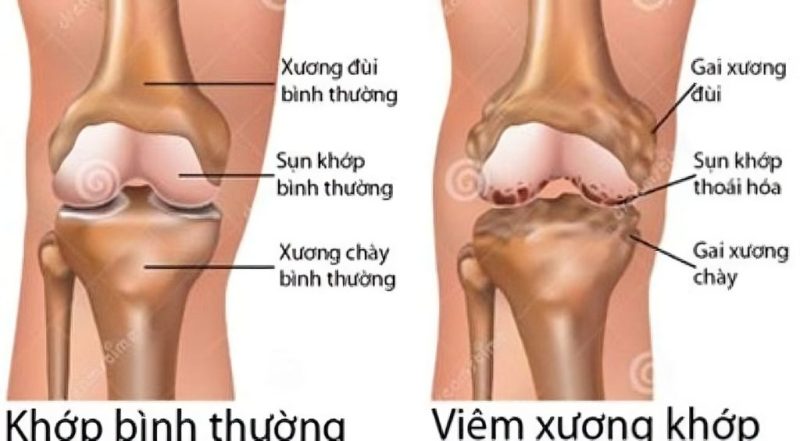 Cách uống nước nghệ tươi giảm axit uric- Ảnh 1. Cách uống nước nghệ tươi giảm axit uric- Ảnh 1.