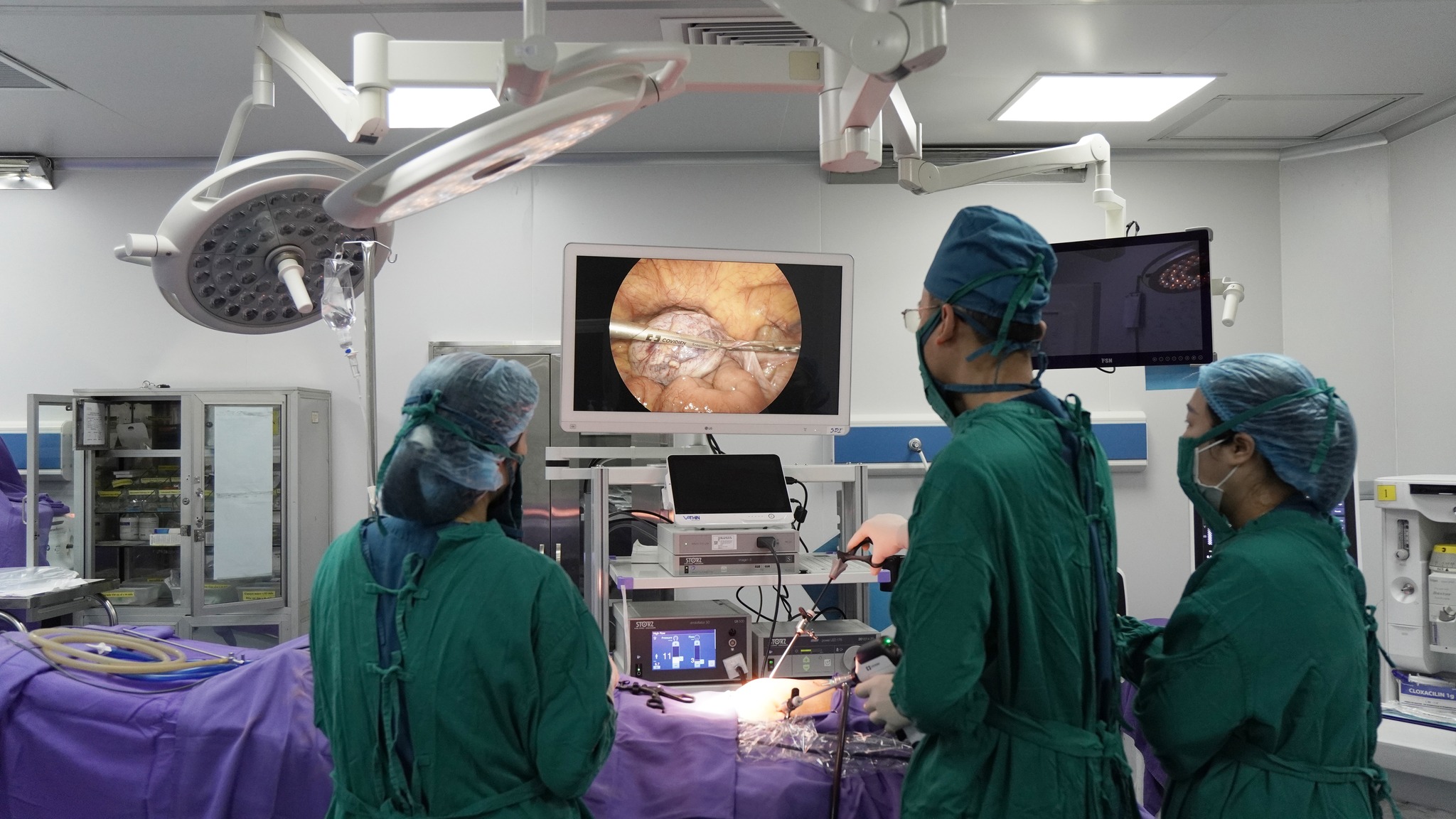 آلام غير عادية في البطن، امرأة ثمانينية تكتشف إصابتها بكيس على المبيض - صورة 1. Đau bụng bất thường, cụ bà 80 tuổi phát hiện mắc u nang quái buồng trứng- Ảnh 1.