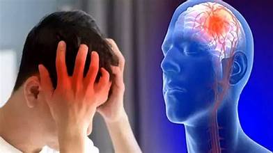 Cách phòng ngừa đột quỵ trong mùa đông- Ảnh 1. Cách phòng ngừa đột quỵ trong mùa đông- Ảnh 1.