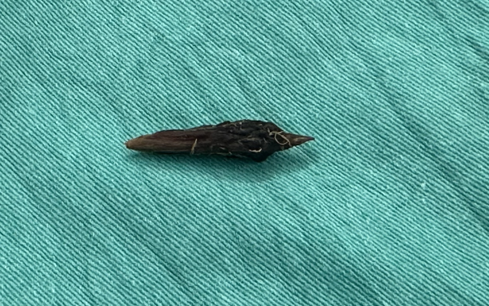 Ăn yến chưng táo đỏ, vô tình nuốt hạt, người phụ nữ phải vào viện cấp cứu