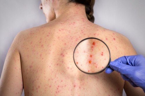 Thai nhi bị ảnh hưởng thế nào nếu người mẹ nhiễm rubella?- Ảnh 1.