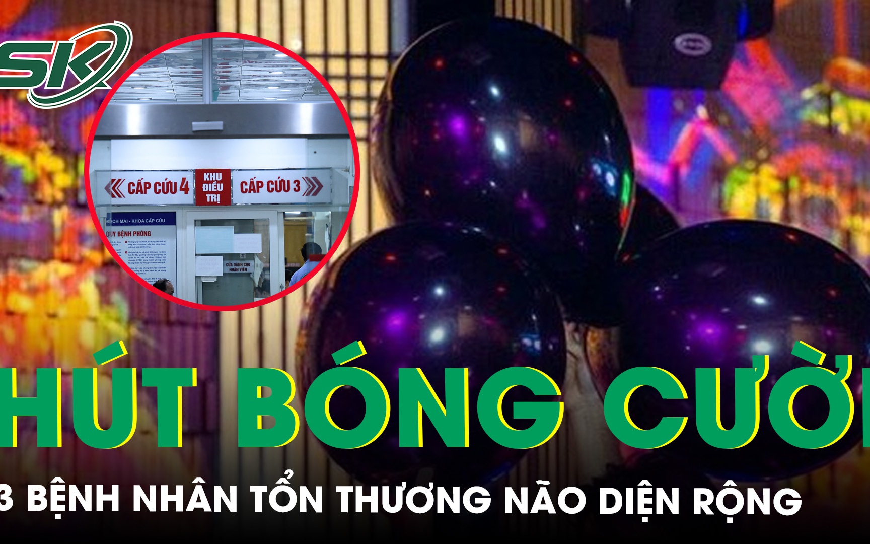 Hút bóng cười, 3 bệnh nhân nguy kịch, tổn thương não diện rộng 