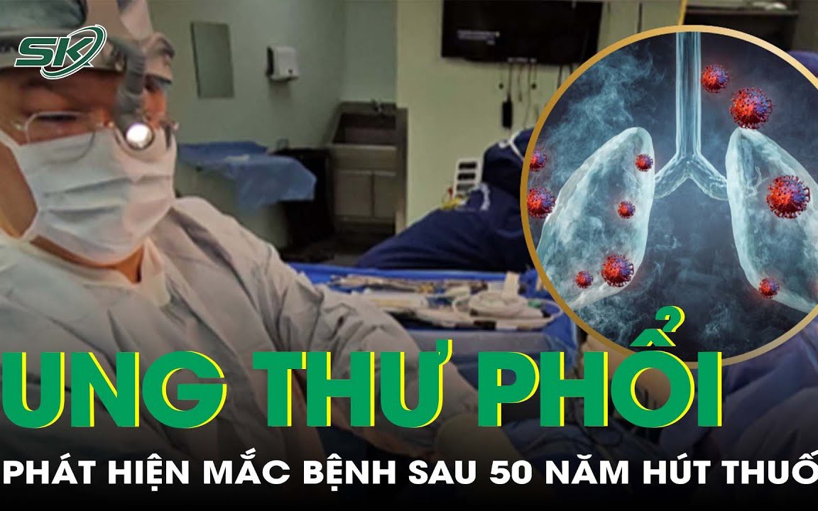 Phát hiện mắc ung thư phổi sau 50 năm hút thuốc lào