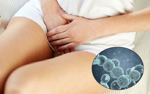 Nhiễm nấm Candida có gây vô sinh không?