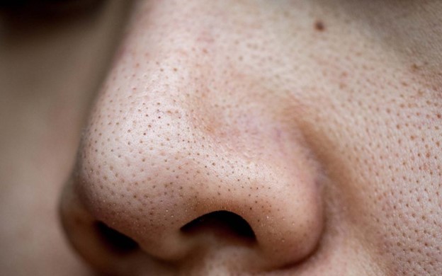 10 cách giúp thu nhỏ lỗ chân lông