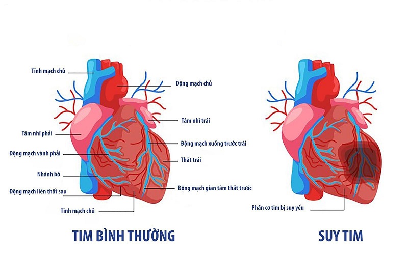 Sau 60 tuổi phụ nữ cần đi bộ bao nhiêu bước?- Ảnh 2.