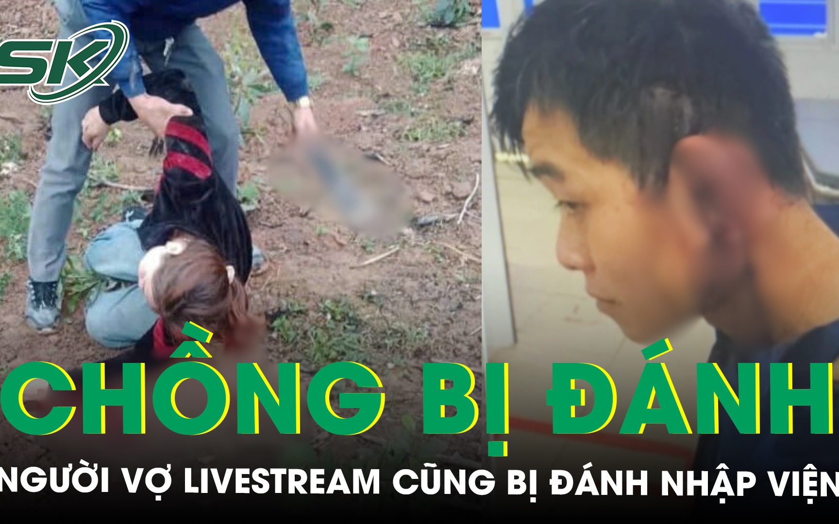 Vợ bị đánh nhập viện vì livestream cảnh chồng bị người khác hành hung, nghi do mâu thuẫn đất đai