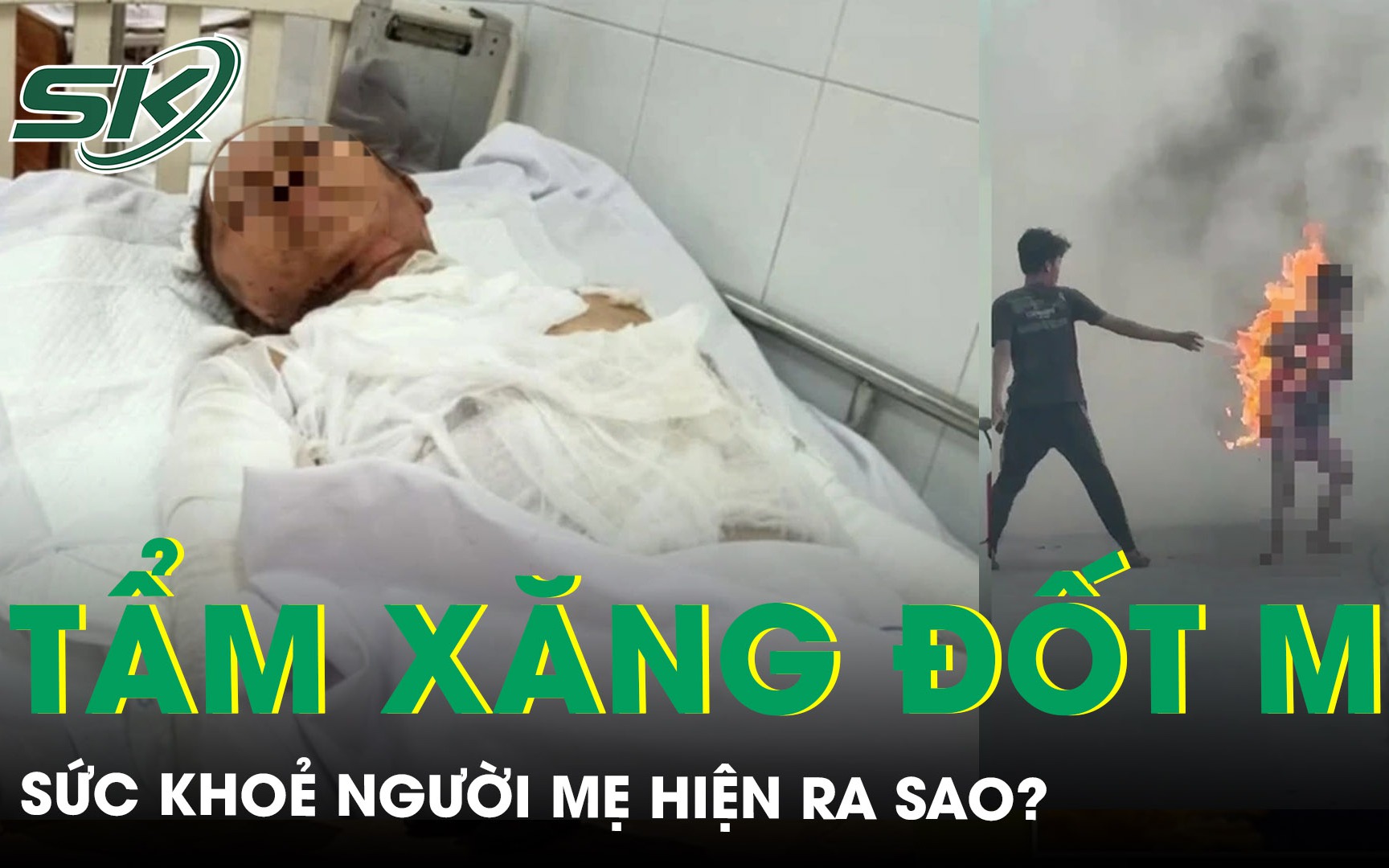 Sức khoẻ của người mẹ trong vụ con trai tưới xăng đốt mẹ ruột