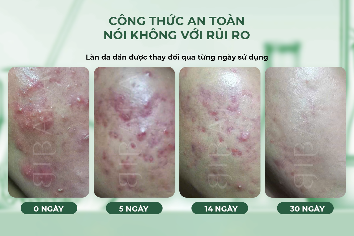 Triết lý 'tỉnh thức' tạo ra sự khác biệt cho một thương hiệu mỹ phẩm Việt Nam - BIBALA- Ảnh 3.