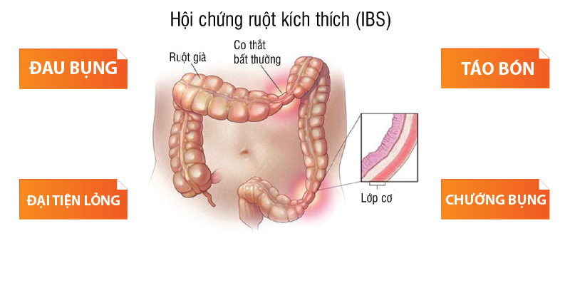 7 liệu pháp giúp tiêu hóa tốt, tăng cường sức khỏe đường ruột- Ảnh 2.