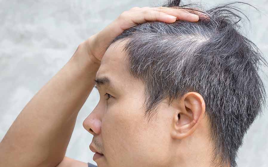 Thực phẩm người tóc bạc sớm nên ăn