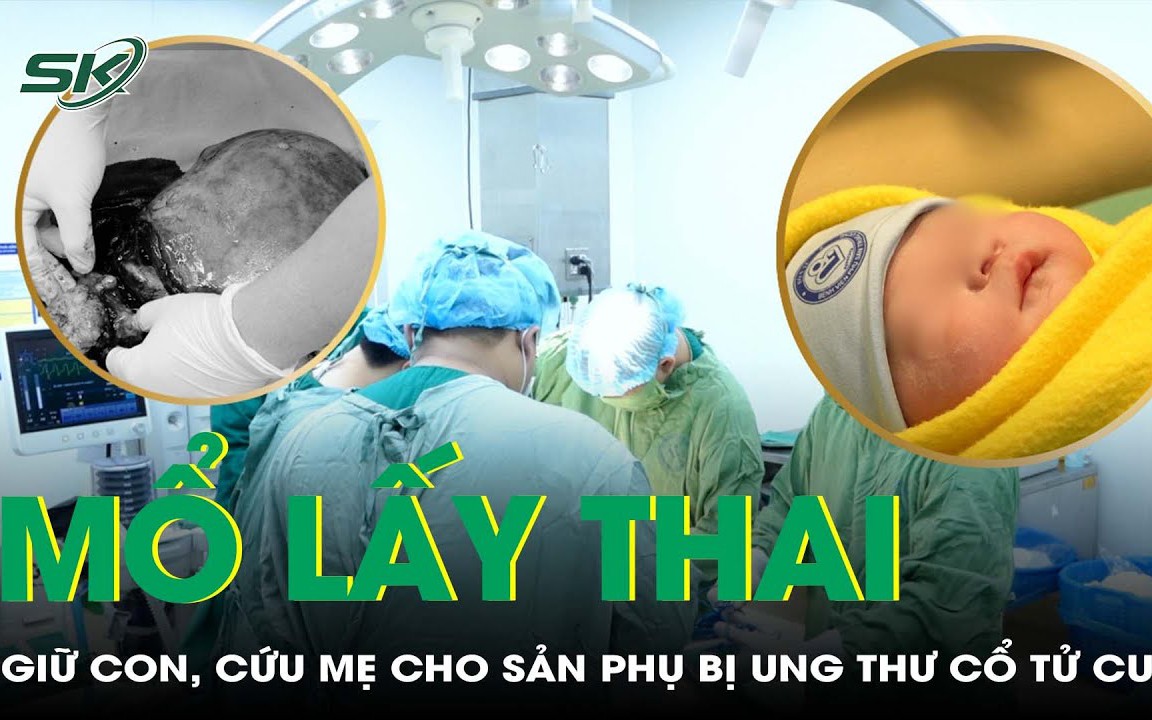 Sản phụ mắc ung thư cổ tử cung và ‘cuộc chiến’ giữ con, cứu mẹ