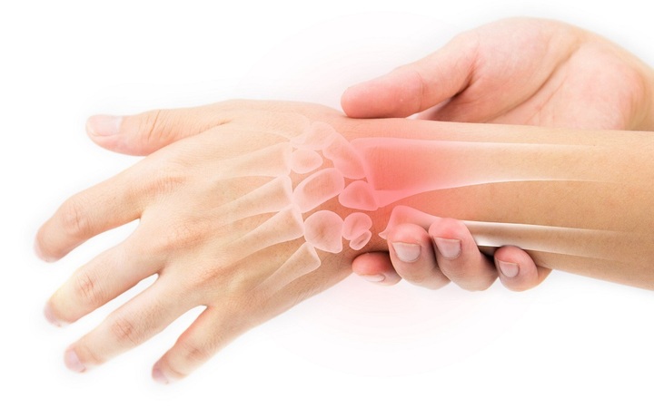 Đau nhức cổ tay, cảnh giác với viêm gân cổ tay- Ảnh 2. Đau nhức cổ tay, cảnh giác với viêm gân cổ tay- Ảnh 2.