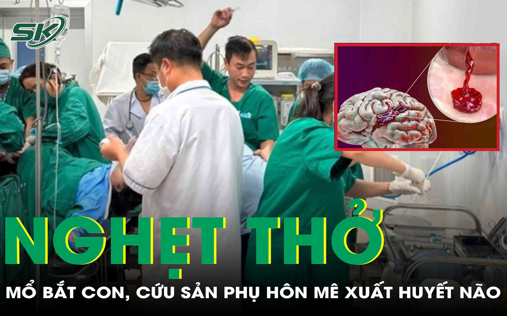 Bác sĩ kể lại giây phút sinh tử giành sự sống cho sản phụ xuất huyết não nguy kịch