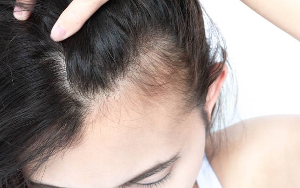 Kích thích mọc tóc nhanh bằng các loại rau quả này