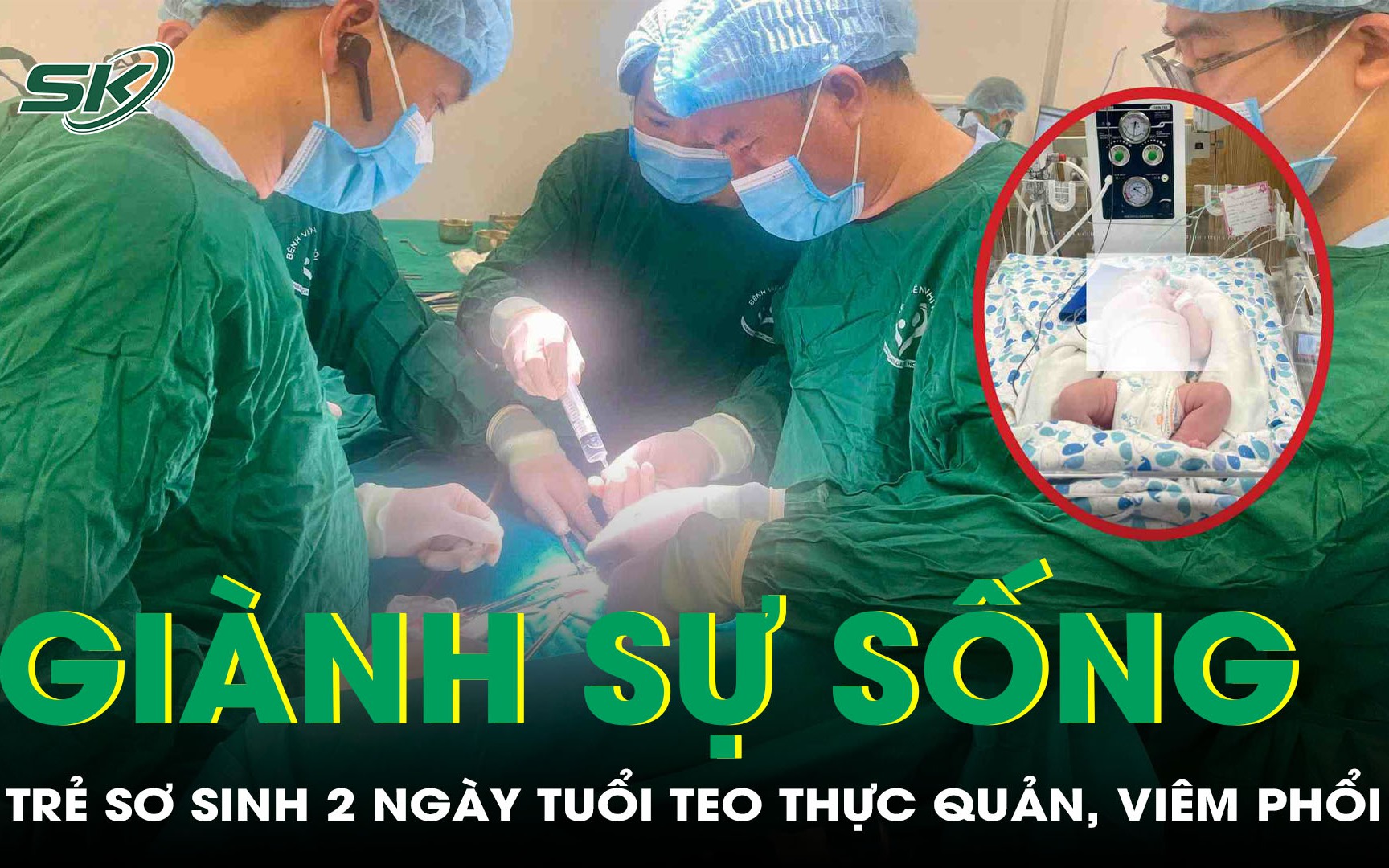 Giành sự sống cho trẻ sơ sinh 2 ngày tuổi mắc teo thực quản, viêm phổi đe dọa tính mạng 