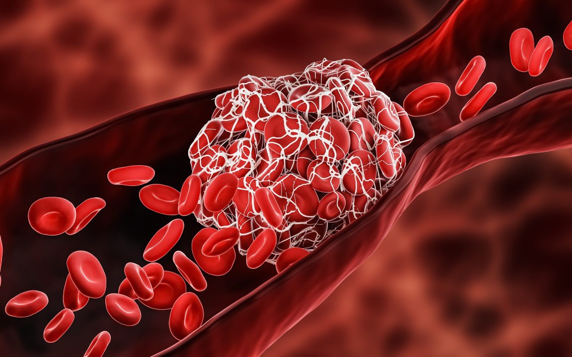 Thuốc điều trị hội chứng kháng thể kháng phospholipid