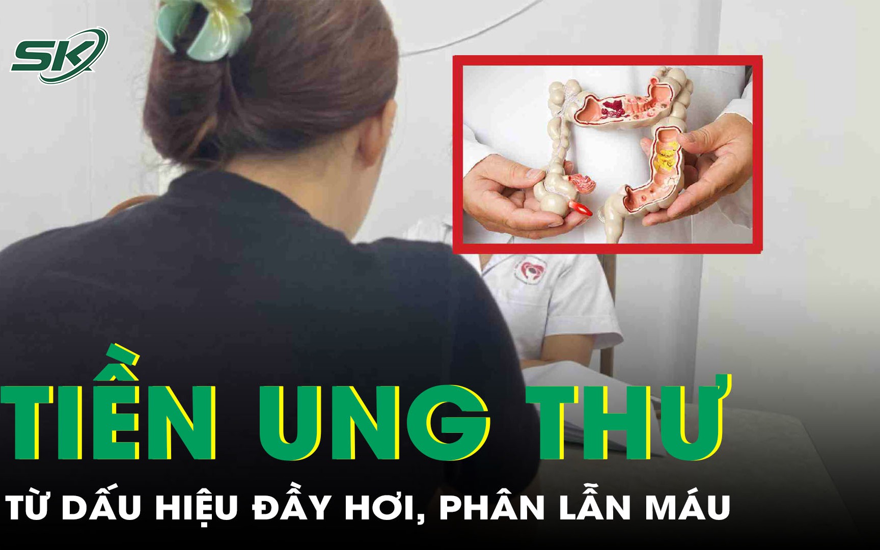 Tưởng rối loạn tiêu hóa, người phụ nữ bàng hoàng phát hiện tiền ung thư 
