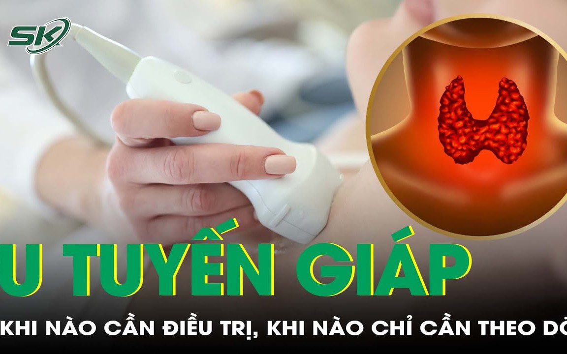 Phát hiện u tuyến giáp: Khi nào cần điều trị, khi nào chỉ cần theo dõi?