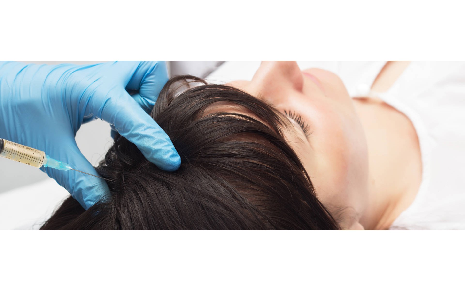 Các thuốc trị rụng tóc thời kỳ mãn kinh