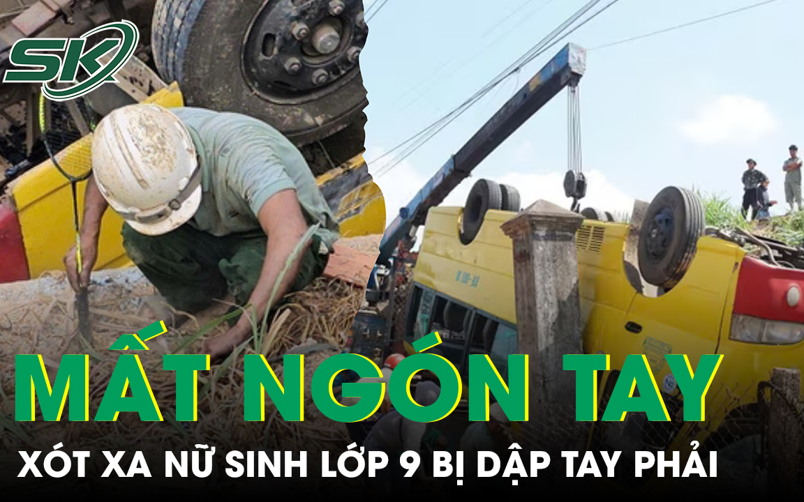 Lật xe chở học sinh, một em bị dập cánh tay phải và nhiều em bị thương