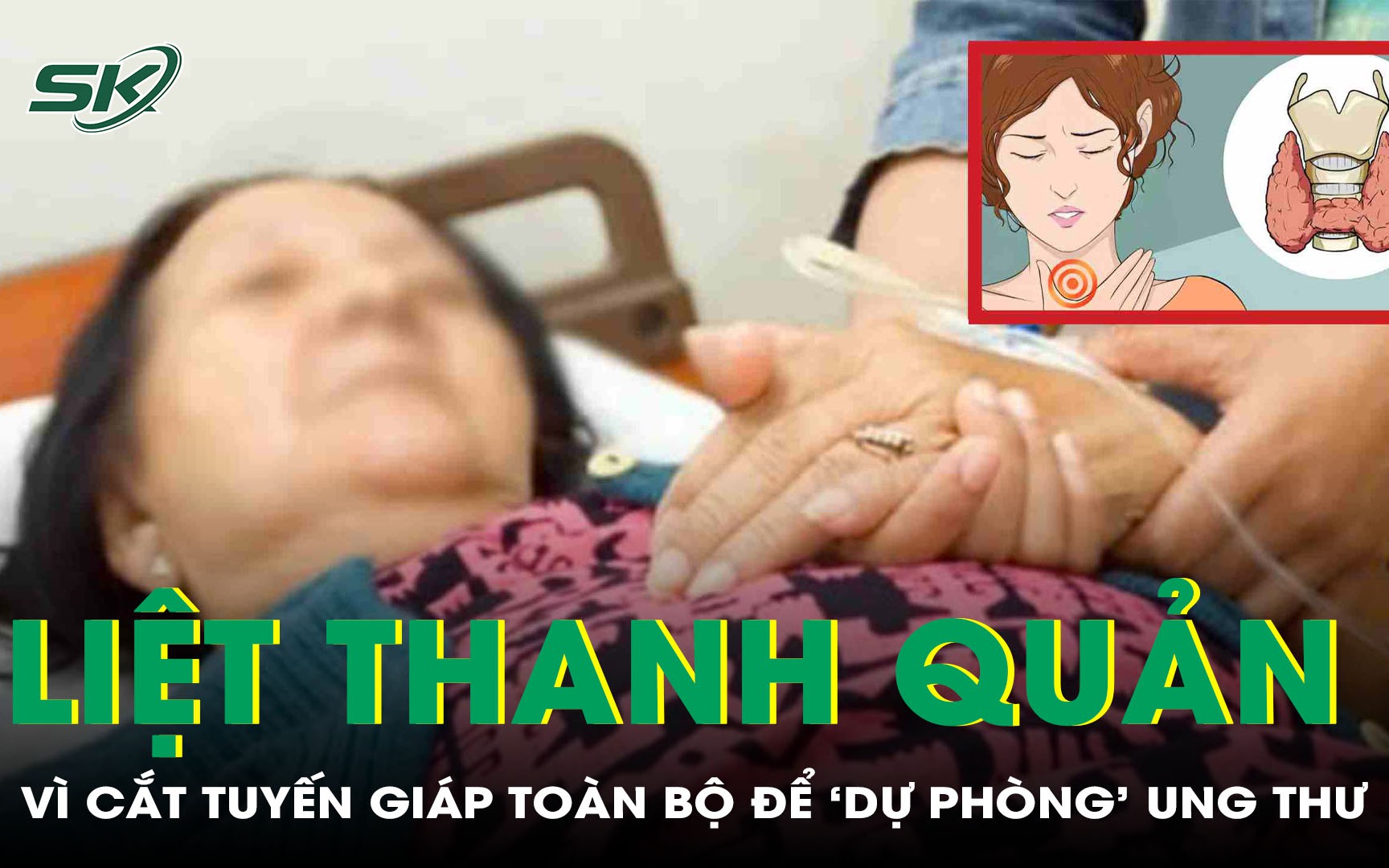 Liệt dây thần kinh thanh quản vì cắt toàn bộ tuyến giáp để 