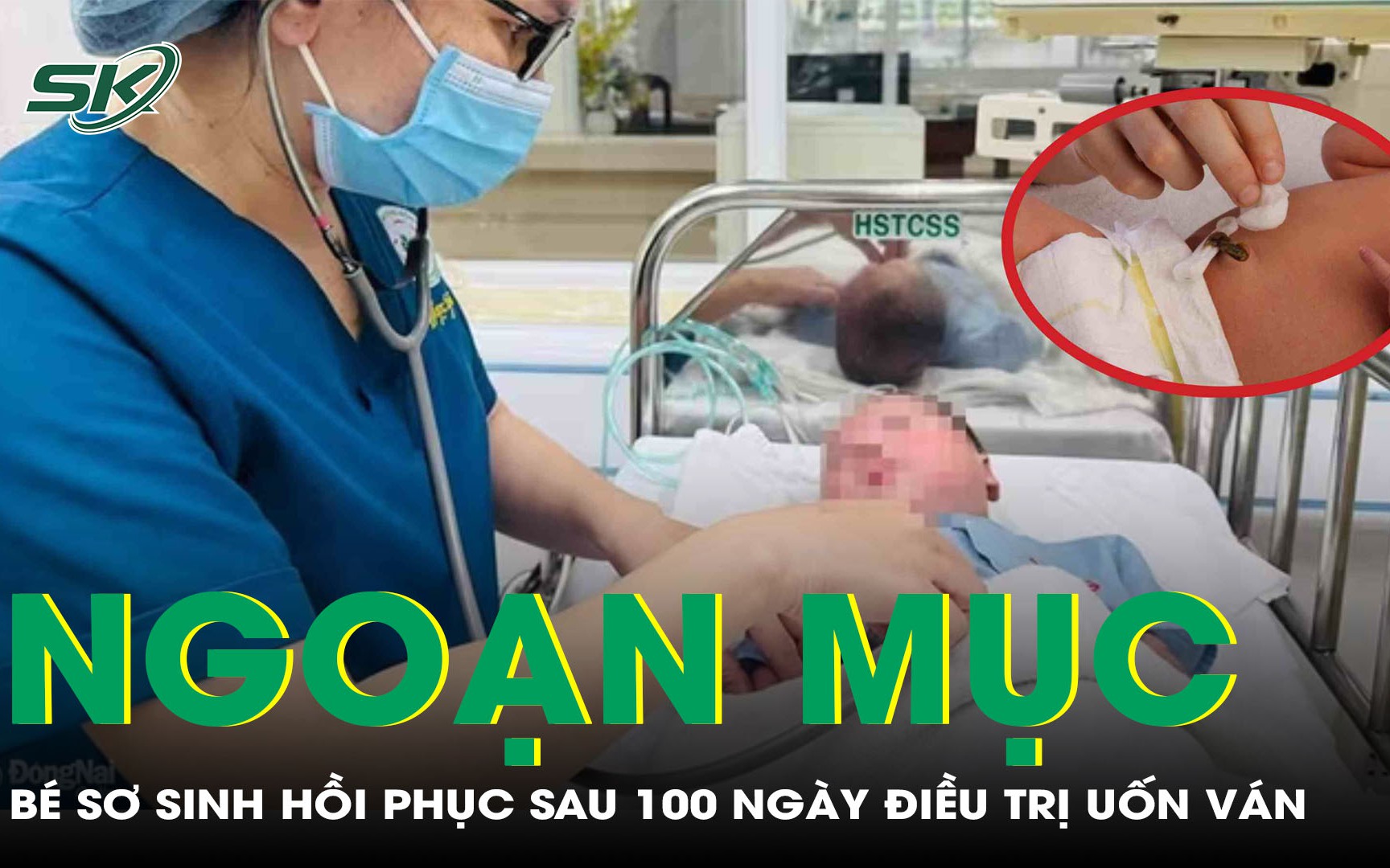 Bé trai sinh non bị uốn ván rốn hồi phục ngoạn mục sau gần 100 ngày điều trị tích cực  