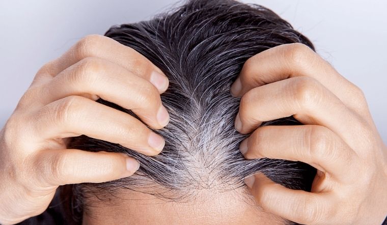 Làm gì để cải thiện tóc bạc sớm, rụng tóc?- Ảnh 1. Làm gì để cải thiện tóc bạc sớm, rụng tóc?- Ảnh 1.