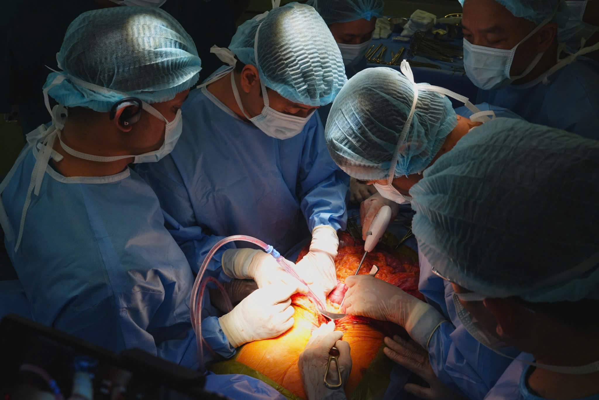 Vợ ‘nén đau thương' hiến tạng của chồng chết não, giúp 4 cuộc đời hồi sinh - Ảnh 2. Vợ ‘nén đau thương' hiến tạng của chồng chết não, giúp 4 cuộc đời hồi sinh - Ảnh 2.