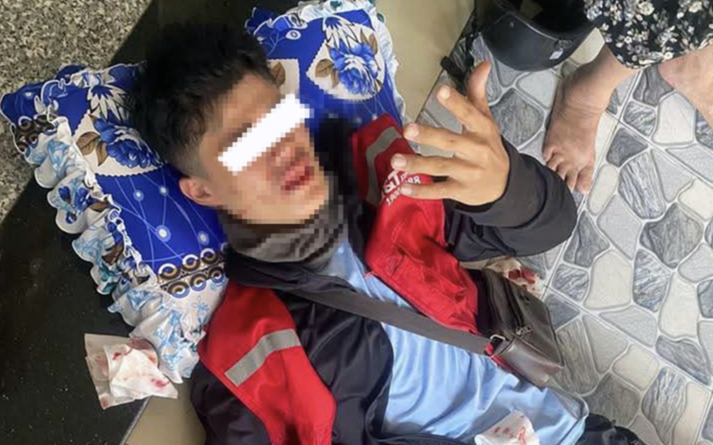 Khách "nợ" tiền hàng, đánh shipper chảy máu mũi, sưng trán