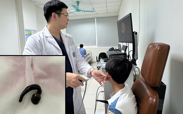 Tắm suối cùng anh trai, bé 3 tuổi bị đỉa 5cm chui vào khí quản