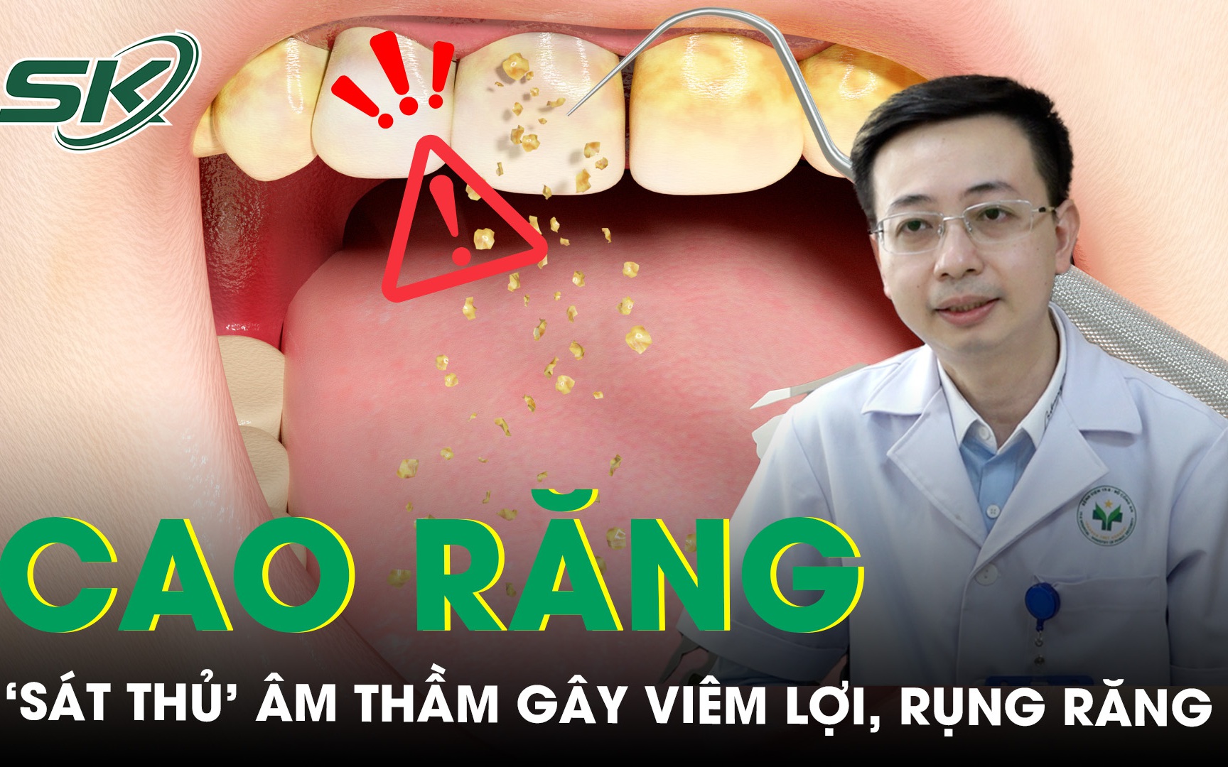 Cao răng - ‘Sát thủ