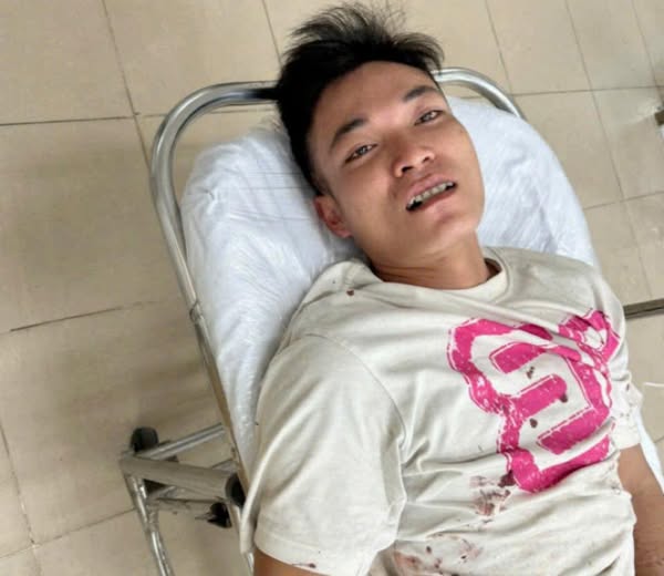 Phát hiện đối tượng bị truy nã sau vụ tai nạn giao thông- Ảnh 1. Phát hiện đối tượng bị truy nã sau vụ tai nạn giao thông- Ảnh 1.