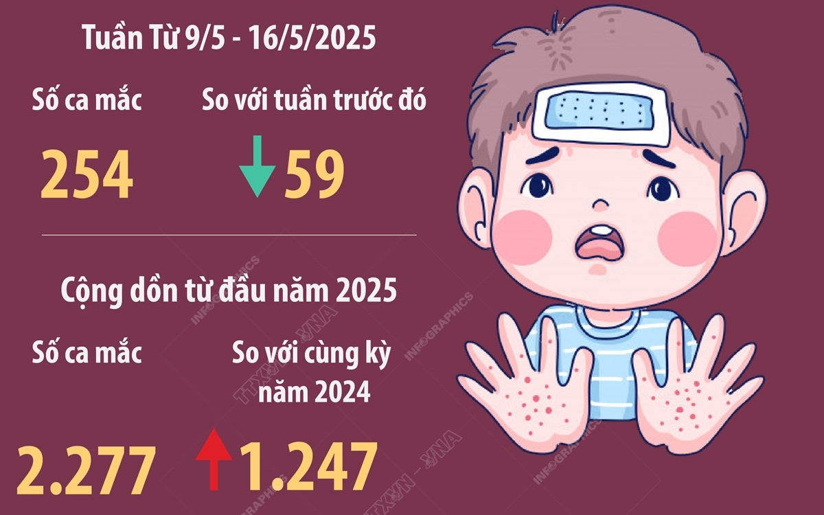 Hà Nội: 254 ca mắc tay chân miệng trong một tuần