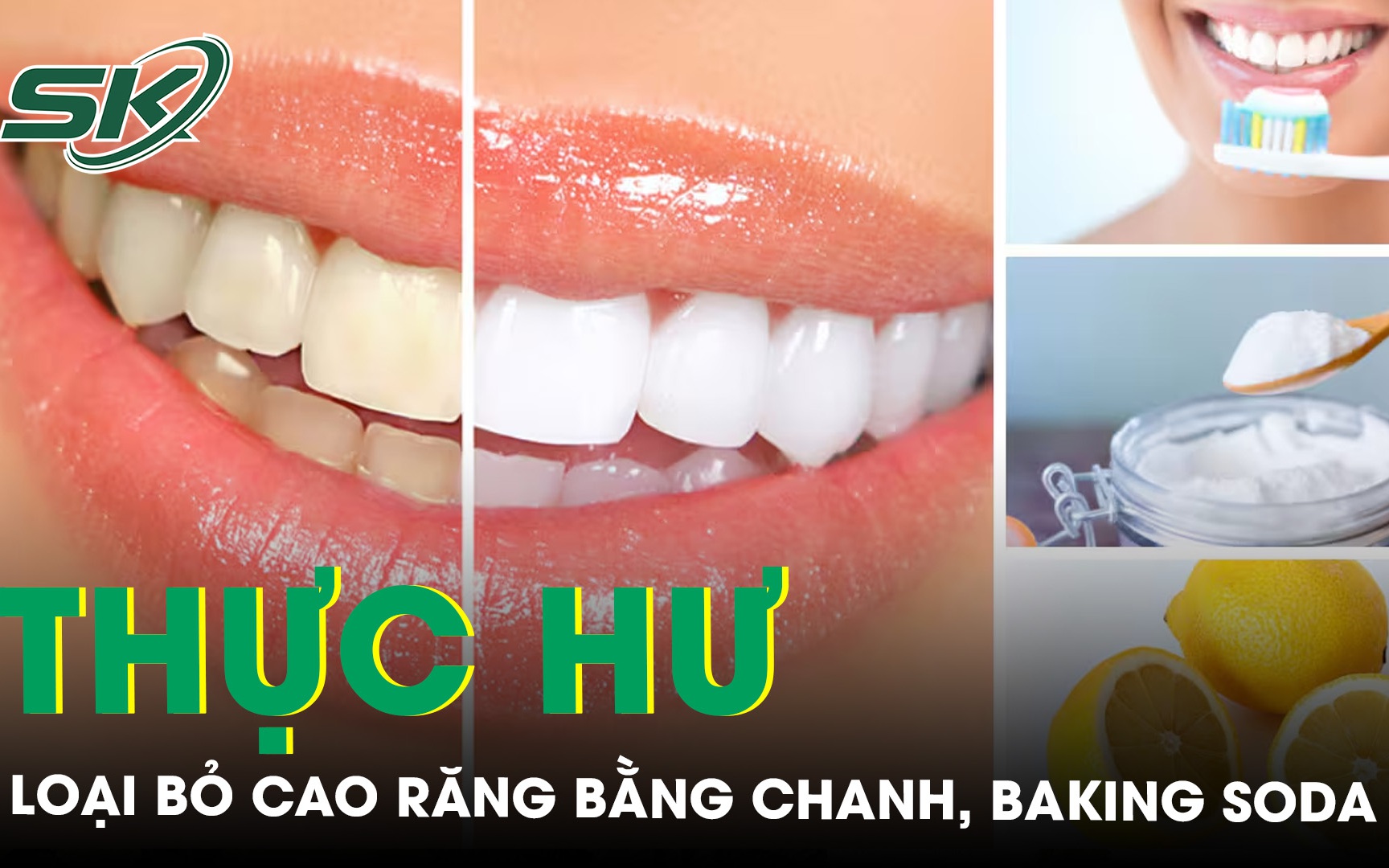 Thực hư loại bỏ cao răng bằng chanh, baking soda