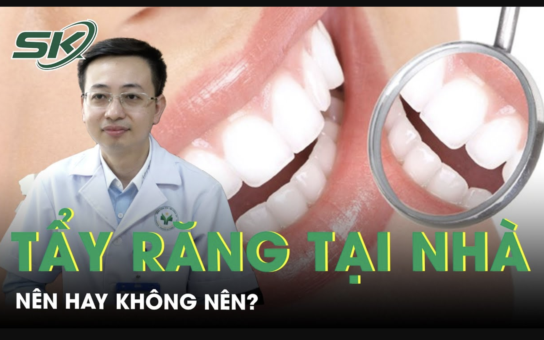 Tẩy trắng răng tại nhà nên hay không nên?