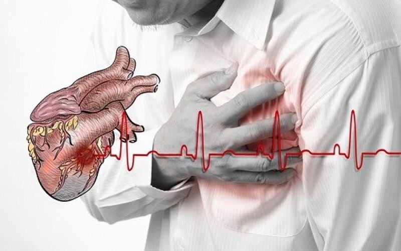 Các yếu tố nguy cơ gây nhồi máu cơ tim