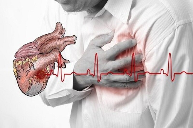 Các yếu tố nguy cơ gây nhồi máu cơ tim- Ảnh 1. Nguyên nhân nhồi máu cơ tim và dấu hiệu nhận biết điển hình