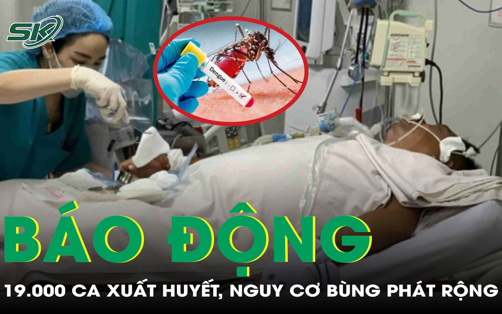 Gần 19.000 ca mắc sốt xuất huyết, báo động nguy cơ bùng phát phức tạp 