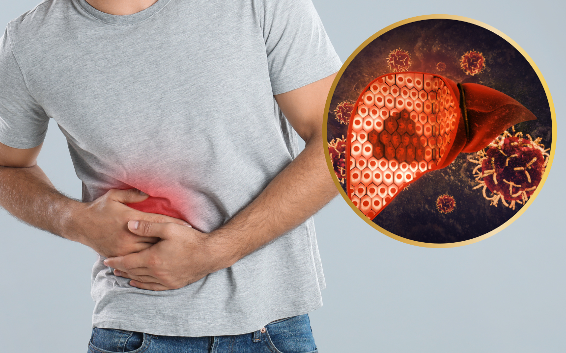 Chán ăn, đầy bụng tưởng đơn giản, đi khám phát hiện ung thư gan giai đoạn cuối