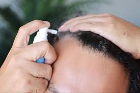Thuốc điều trị rụng tóc tại chỗ có thể gây rối loạn cương dương, lo âu và sương mù não- Ảnh 1. Thuốc điều trị rụng tóc tại chỗ có thể gây rối loạn cương dương, lo âu và sương mù não- Ảnh 1.