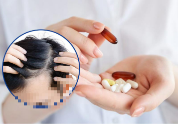 Các phương pháp điều trị rụng tóc tốt nhất cho phụ nữ- Ảnh 2. Các phương pháp điều trị rụng tóc tốt nhất cho phụ nữ- Ảnh 2.