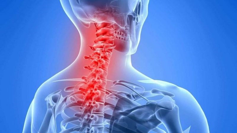 Đau cổ vai gáy có nguy hiểm, khi nào là bệnh lý phải nhập viện?- Ảnh 1. Đau cổ vai gáy có nguy hiểm, khi nào là bệnh lý phải nhập viện?- Ảnh 1.