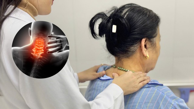 Tối ưu hóa hiệu quả điều trị thoát vị đĩa đệm đốt sống cổ bằng kết hợp Đông – Tây y- Ảnh 1.